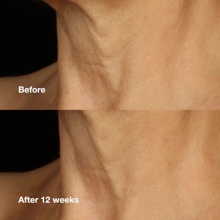 CLINIQUE -  SMART CLINICAL REPAIR - LIFTING FACE / NECK CREAM - 50ML