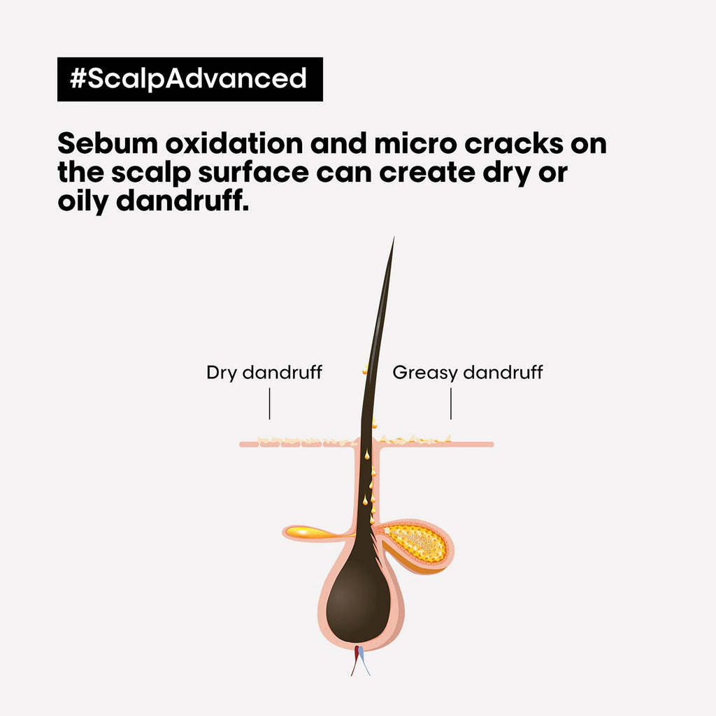 LOREAL - S.E - SCALP ADVANCE SHAMPOO - ANTI DANDRUFF SH - 300 ML