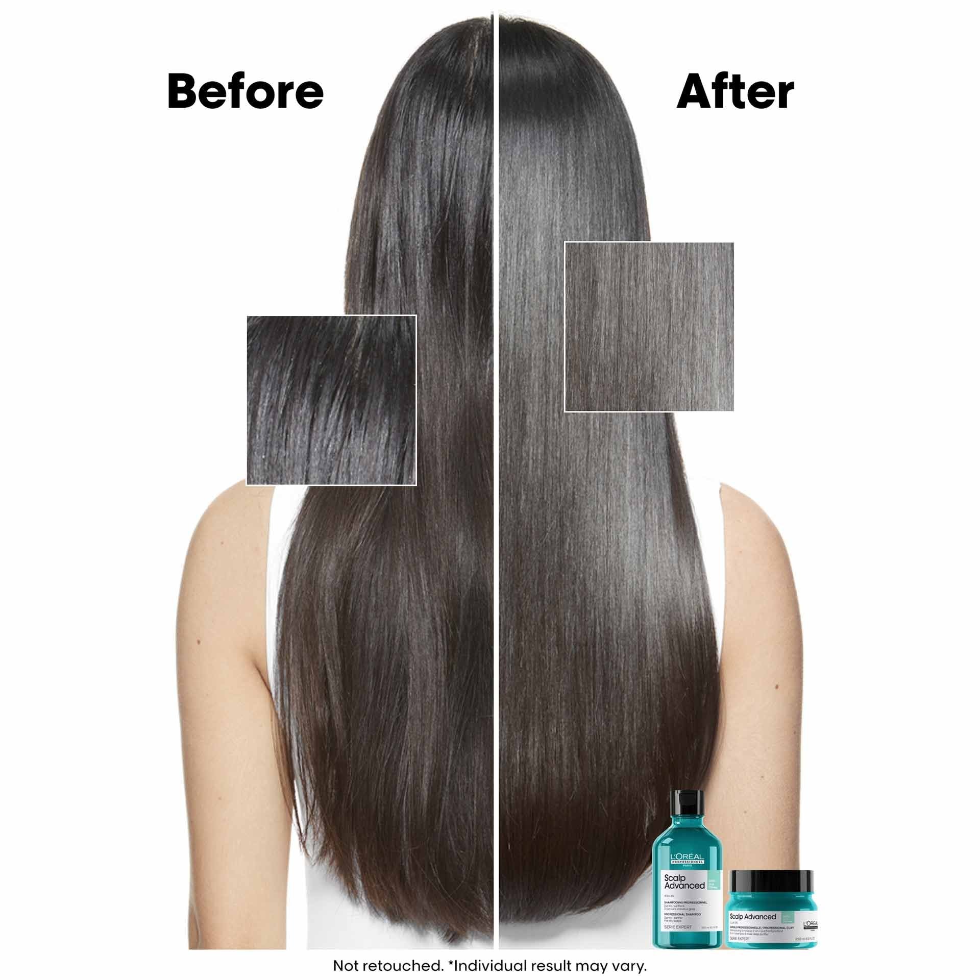 LOREAL - S.E - SCALP SHAMPOO OILINESS - 300 ML